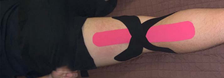 Chiropractic Culver City CA Kinesio Taping