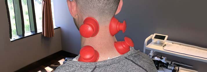 Chiropractic Culver City CA Neck Pain Chiropractic Culver City CA Neck Pain